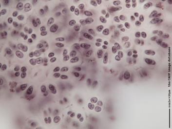 R001b 100x.JPG